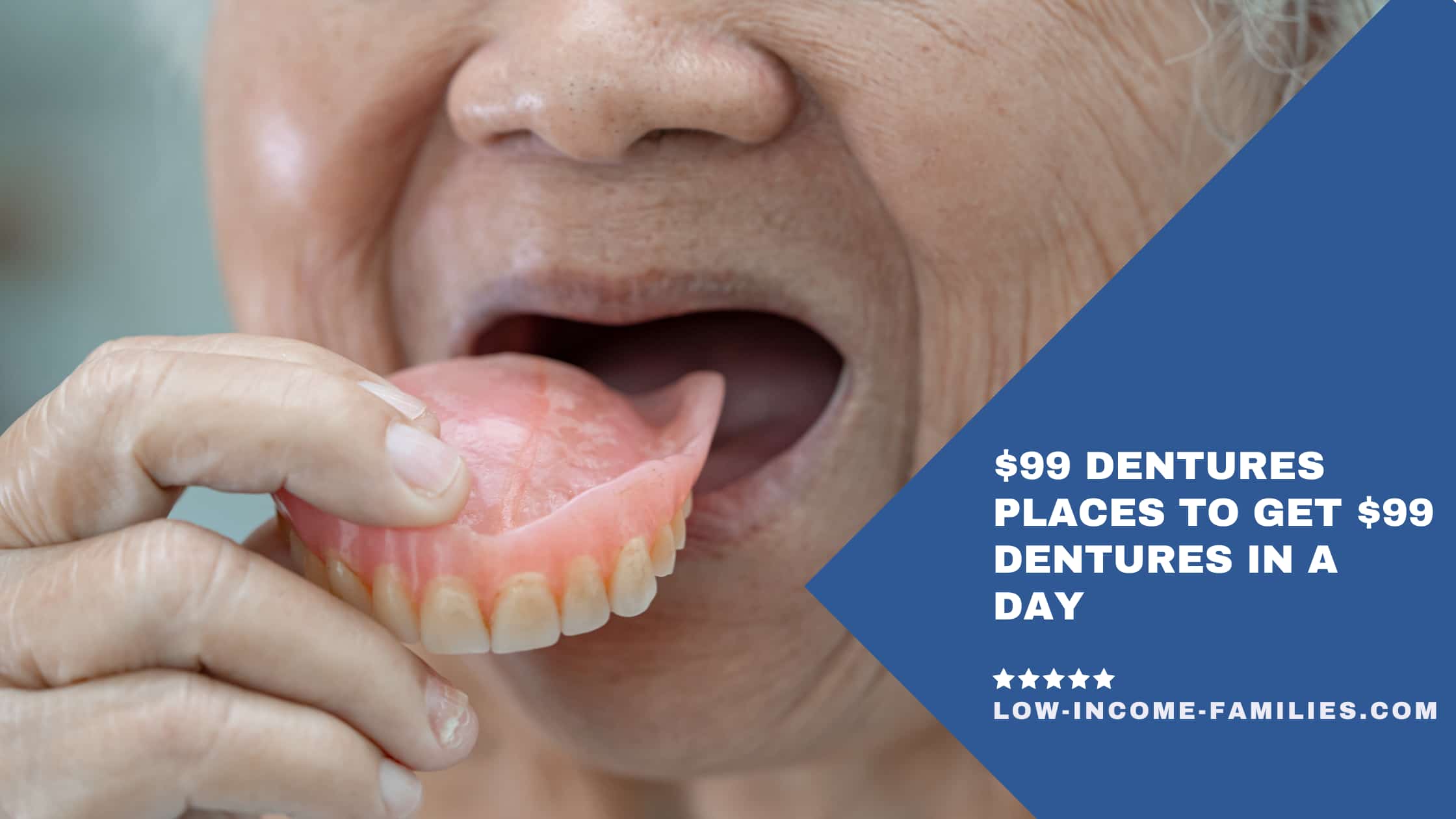 $99 Dentures Places to Get $99 Dentures in a Day [5 Program ]
