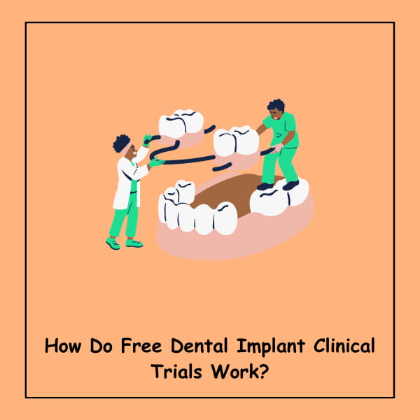 How Do Free Dental Implant Clinical Trials Work?