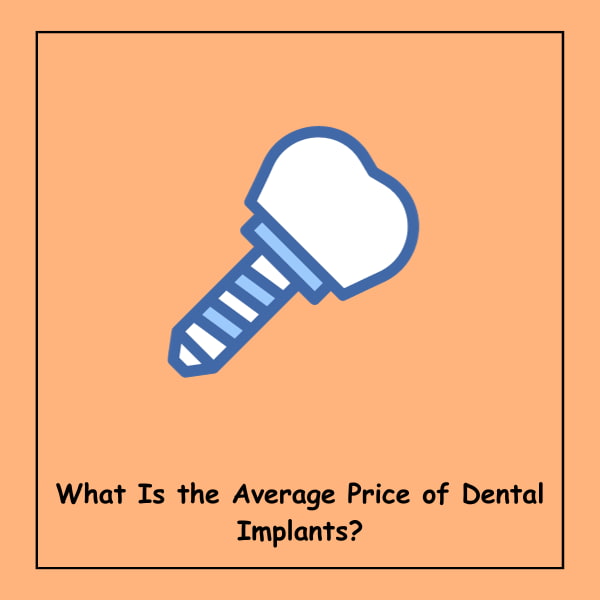 What Is the Average Price of Dental Implants?
