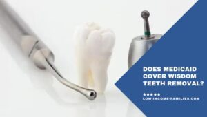Does Medicaid Cover Wisdom Teeth Removal?