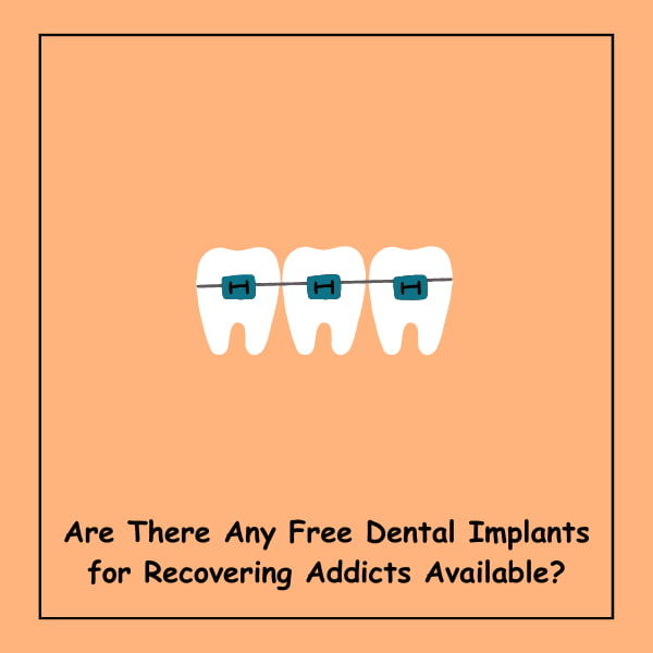 Are There Any Free Dental Implants for Recovering Addicts Available?