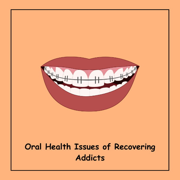 Oral Health Issues of Recovering Addicts